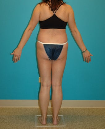 Midlife make-over after 286164