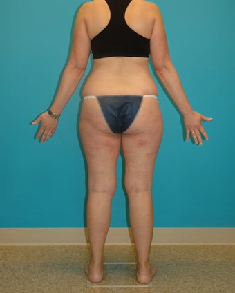 Midlife make-over before 286164
