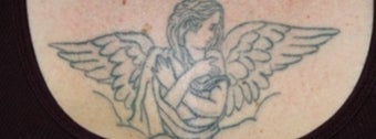 Laser tattoo removal before 374507