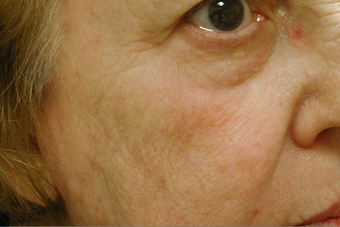 Affirm CO2 after 200601