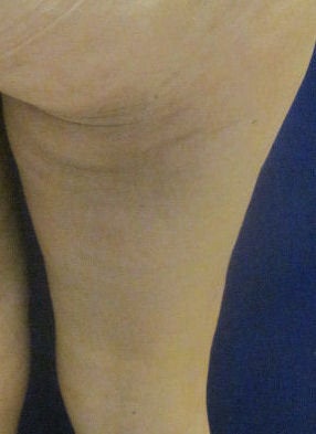 Cellulaze 593042
