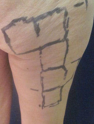 Cellulaze 593042