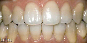 Tetracycline before 234635