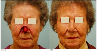 Facial Reconstruction before 136843