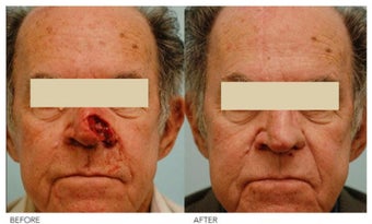 Facial Reconstruction before 136841