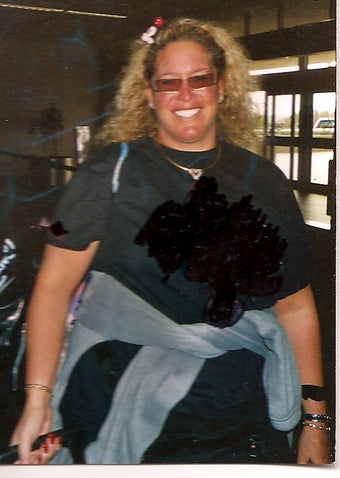 Gastric Bypass before 233096