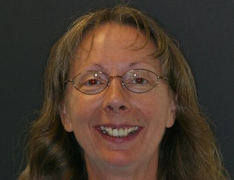 Smile Makeover before 375004
