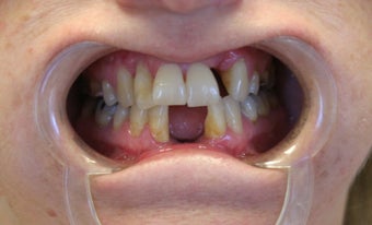 smile make over before 466361