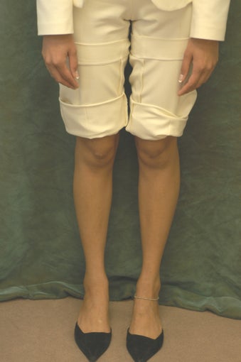 Women's Calf Augmentation 519047