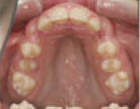Damon System Braces 477299