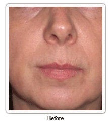 Evolence: a naturally younger-looking you before 54975