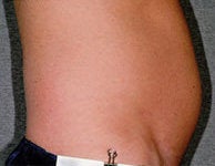 Liposonix 582688