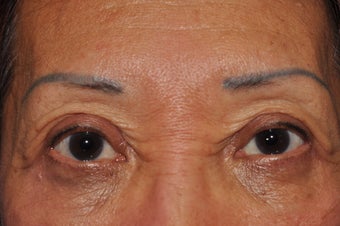 Permanent Eyeliner before 493461