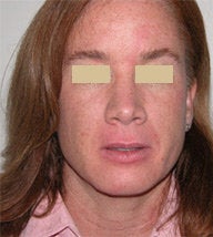 Skincare before 112110
