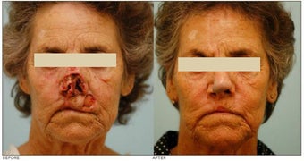 Facial Reconstruction before 136840