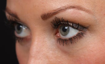 Filler for Under-Eye Hollows before 1350727