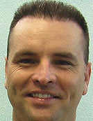 FUE-BHT hair transplantation using head and body hair after 195015