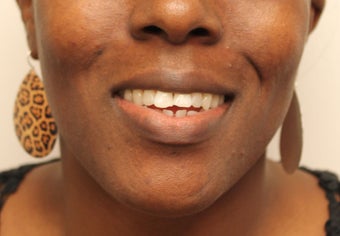 Dimple Creation before 598459