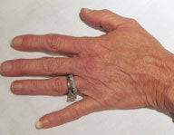 Injectables before 112086