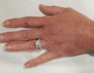 Injectables after 112086