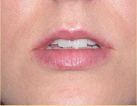 Injectables before 112080