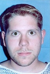 Otoplasty before 251843