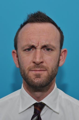 27-year-old male treated with BOTOX for Deep Forehead lines before 924501