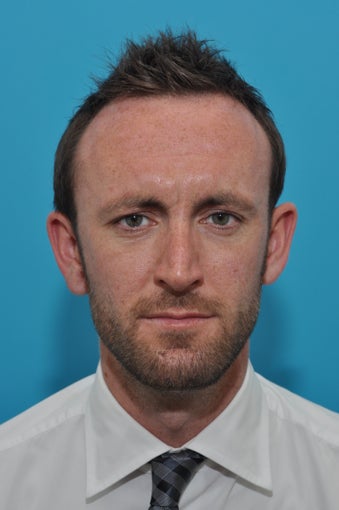 27-year-old male treated with BOTOX for Deep Forehead lines after 924501