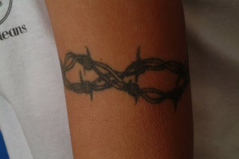 QSR Ruby Laser Tattoo Removal before 329682