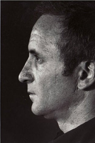 Rhinoplasty after 321999