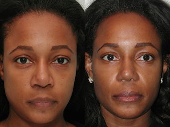 African American Female before 44104