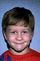 Young boy with protruding ears