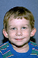 Young boy with protruding ears
