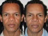 45 year old Afro-Hispanic Male Rhinoplasty