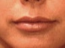 Lips