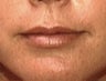 Lips
