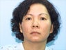 Skin Treatment Using Obagi NuDerm System