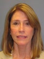 LiteLift™ and Platysmaplasty on 63-year-old Woman