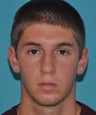 Rhinoplasty and chin augmentation in young male