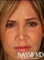 Female Primary Rhinoplasty