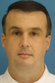 Chin/Neck Liposuction