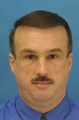 Chin/Neck Liposuction