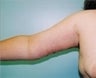 28 year old female patient