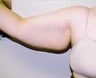 28 year old female patient