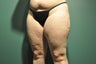 Cellulaze