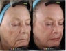 Pigmentation