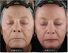 Pigmentation