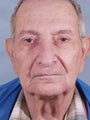 Peripheral vision loss due to hooding of upper eye lids.