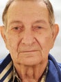 Peripheral vision loss due to hooding of upper eye lids.