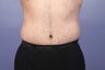 37 yr old male weight loss patient
